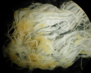 Ovary of a laying queen. Indivial ovarioles can be seen, with more mature eggs shown as yellowish. Egg cells move down the tube of overioles and become larger and more mature, eventually reaching the oviduct and being laid out by the queen.