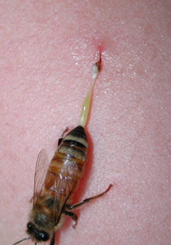 A worker bee trying to get away after stinging. The sting has barbs preventing the sting to be pulled out, part of her digestive system is seen dragging behind her.